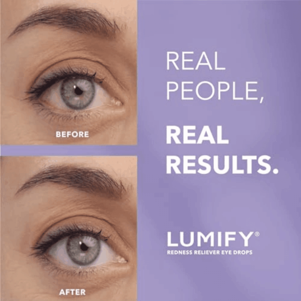 Redness Reliever Eye Drops, for Whiter & Brighter Looking Eyes, 0.08 Fl Oz (2.5 Ml) - Image 3