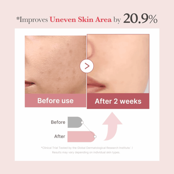 PDRN Pink Collagen Exosome Shot Serum 7,500 PPM | Liquid Skin Booster | Exosome, Salmon DNA PDRN, Spicules | Uneven Skin Tone, Pore Care, Skin Texture | Korean Skin Care 1.01 Fl.Oz - Image 2