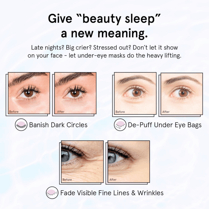 under Eye Patches for Puffy Eyes and Dark Circles (Retinol, 24 Pairs) Restoring Gel under Eye Masks with Hyaluronic Acid - Vegan Cruelty-Free Skincare Birthday Gifts for Women - Image 2