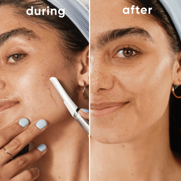 Dermaplaning Tool, 2 Blade Refills, Face Razors for Women, Eyebrow Razor, Exfoliating Face Razor, Face Razors for Women, Facial Razors for Women Face, Dermaplane Razor for Women Face - Image 5