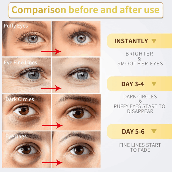 Under Eye Patches - 60 Pcs - 24K Gold Eye Mask- Puffy Eyes & Dark Circles Treatments,Reduce under Eye Bags and Smooth Wrinkles,Eye Skin Care Pads with Collagen,Hyaluronic Acid & Castor Oil - Image 3