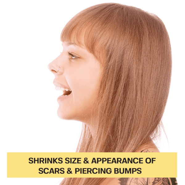 Piercing Keloid Bumps Shrinking Duo | Piercing Bump Treatment (.5Oz) + Keloid Bump Removal Gel (2Oz) | Keloid Scar Removal for All Scars, Keloids & Piercing Bumps - Image 2