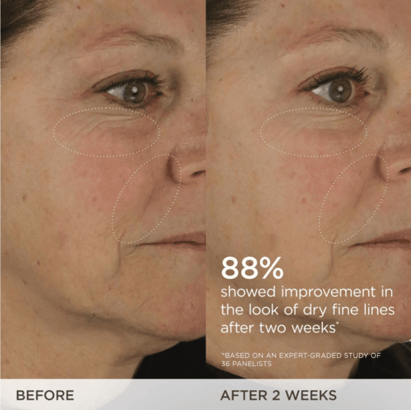 the Dewy Skin Cream | Rich Face Cream to Hydrate, Plump and Protect Dry and Combo Skin, 50 Ml | 1.7 Oz - Image 7