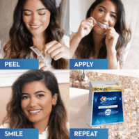 3D Whitestrips Professional Effects, Whitestrip 3D White, Teeth Whitening Strip Kit, 44 Strips (22 Count Pack),  Teeth Whitening Strips, Teeth Whitening Kit - Image 2
