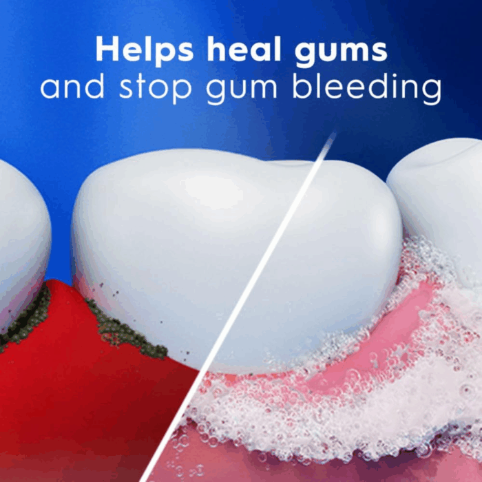 Pro-Health Gum Detoxify plus Toothpaste 4.5 Oz Pack of 3 - Antibacterial Fluoride Toothpaste, Sensitivity Protection, Whitens Teeth, Anticavity, Plaque Control - Image 7